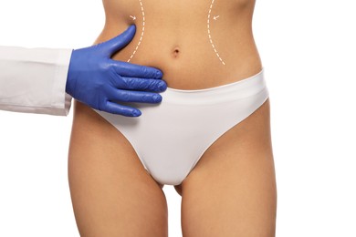 Doctor and patient preparing for cosmetic surgery, white background. Woman with markings on her abdomen, closeup