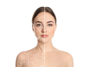 Image of Collage with photos of woman having dry skin problem before and after dry skin problem on white background