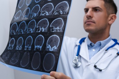Doctor examining MRI images of patient with multiple sclerosis in clinic, closeup
