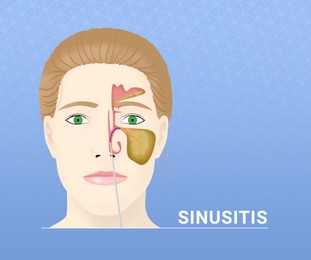 Illustration of  woman with inflamed sinus on light blue background