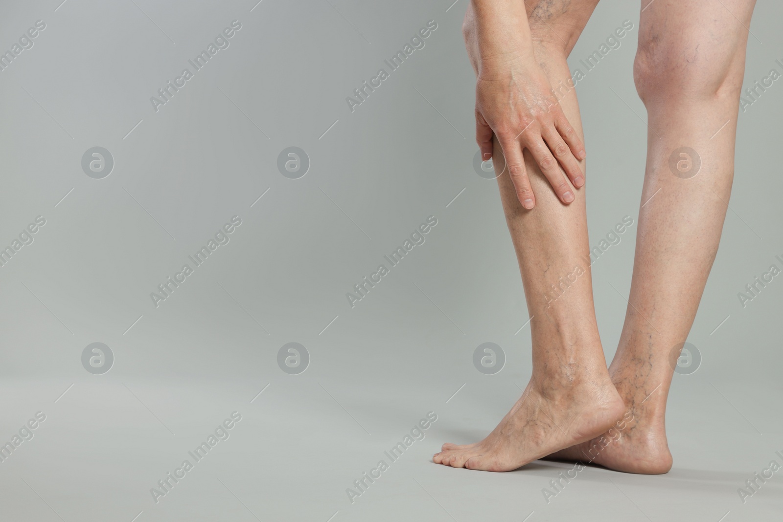 Photo of Closeup view of woman suffering from varicose veins on light grey background. Space for text