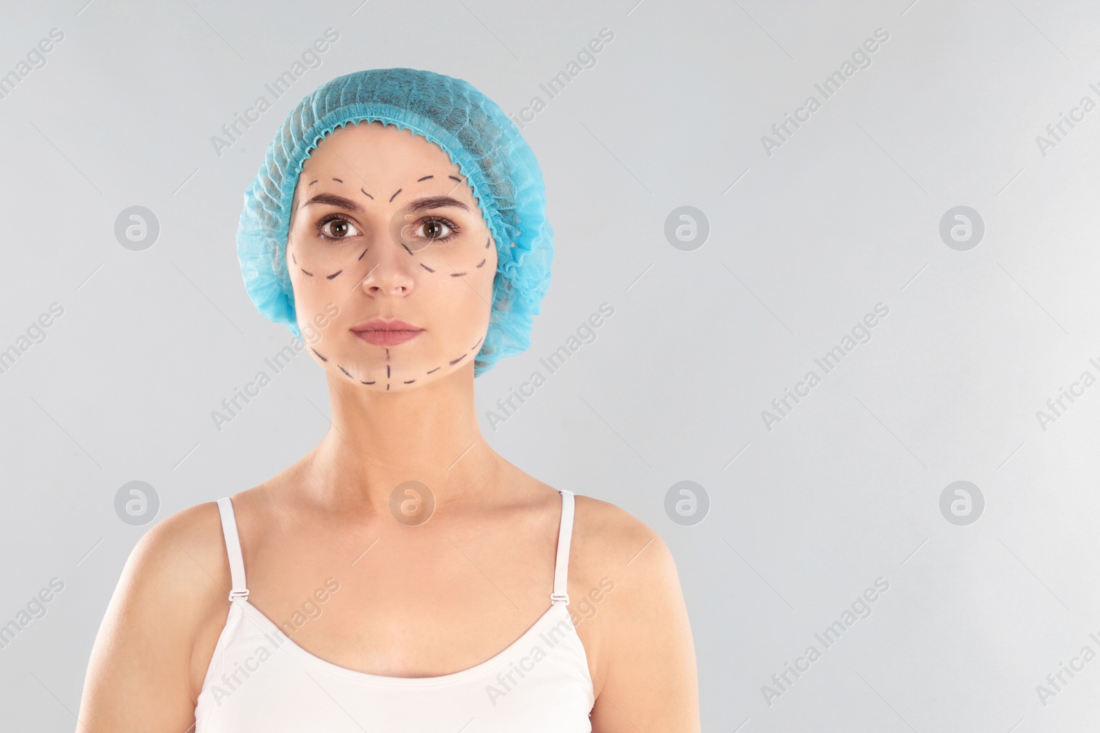 Photo of Portrait of woman with marks on face against grey background, space for text. Cosmetic surgery