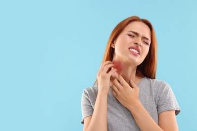 Photo of Suffering from allergy. Young woman scratching her neck on light blue background, space for text