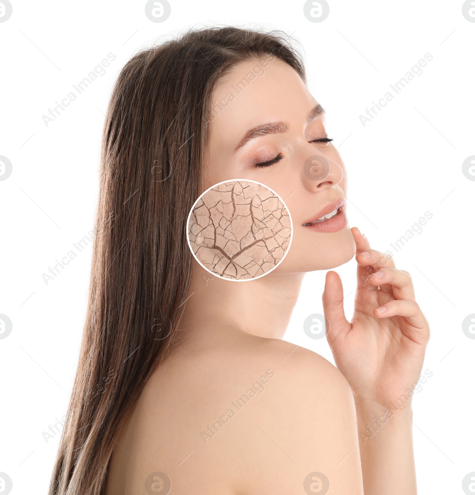 Image of Young woman with facial dry skin problem on white background