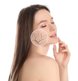 Image of Young woman with facial dry skin problem on white background