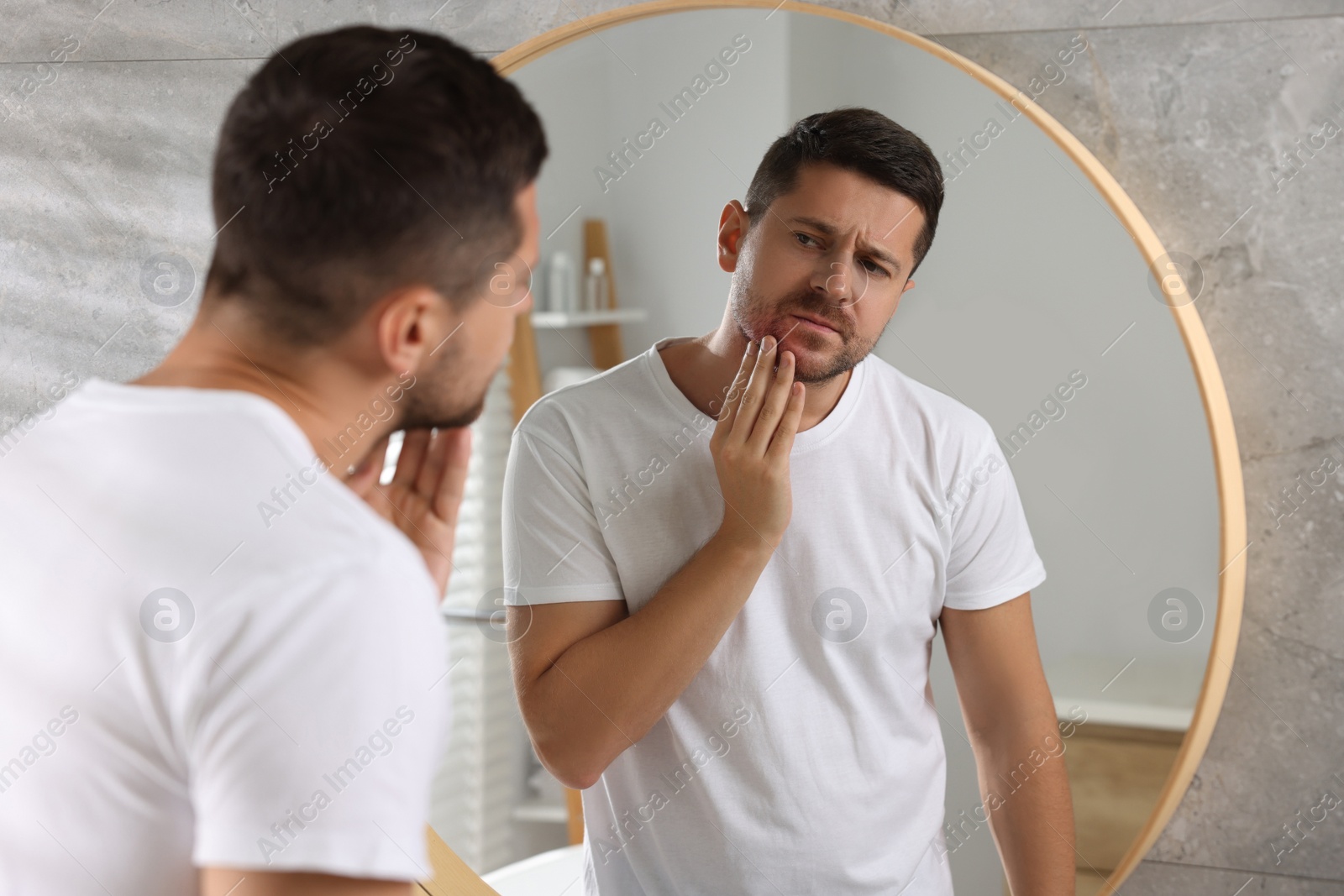 Photo of Man suffering from allergy looking at his skin in mirror indoors