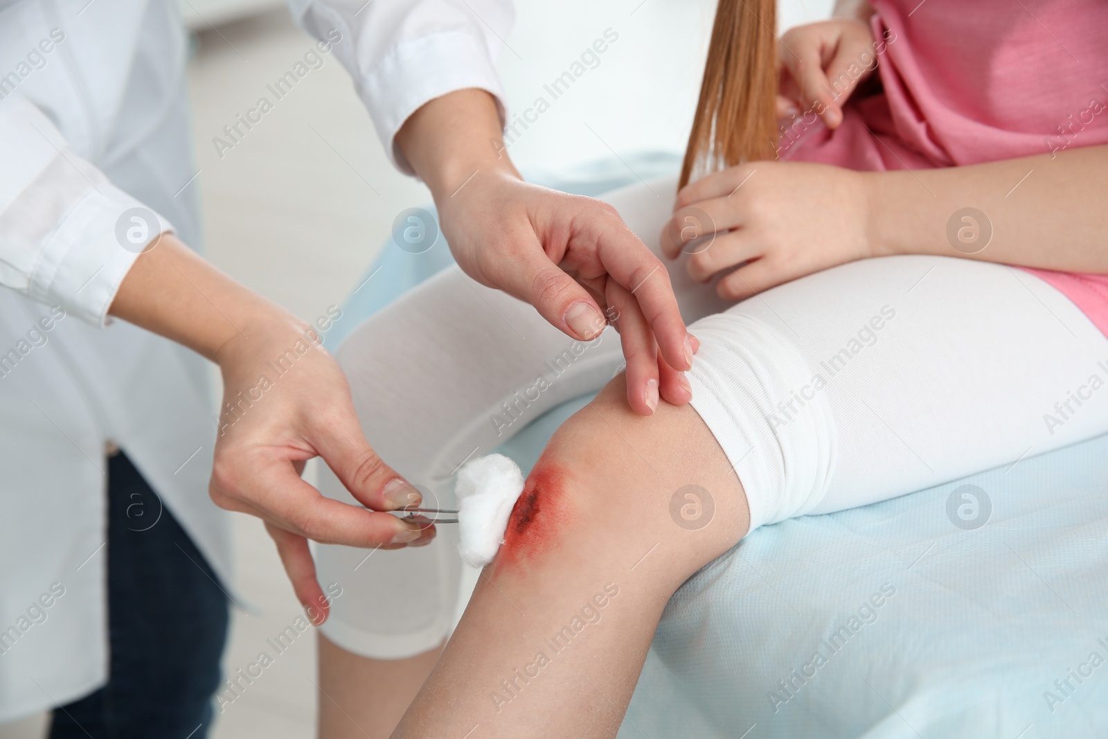 Photo of Female doctor cleaning little girl's leg injury in clinic, closeup. First aid