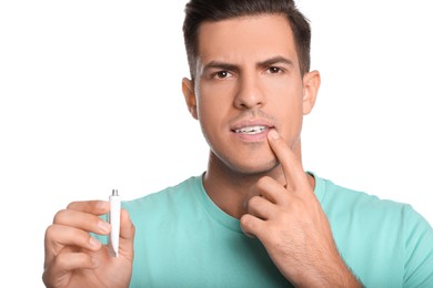 Photo of Man with herpes applying cream on lips against white background