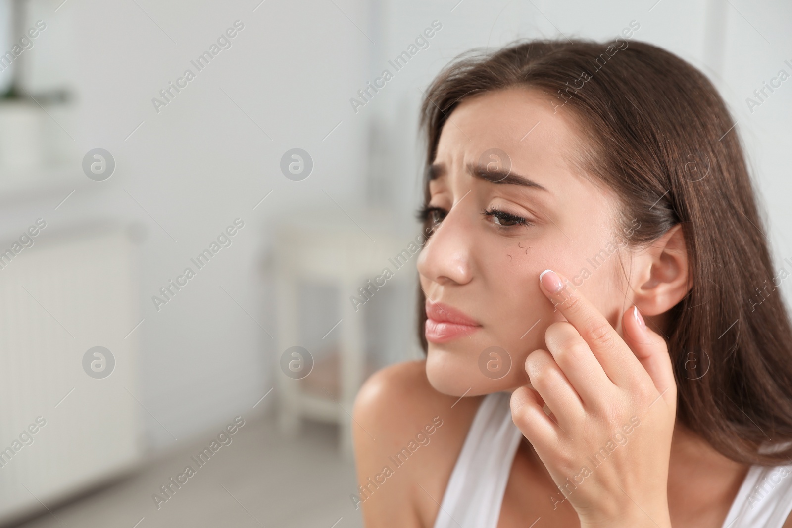 Photo of Young woman with eyelash loss problem indoors