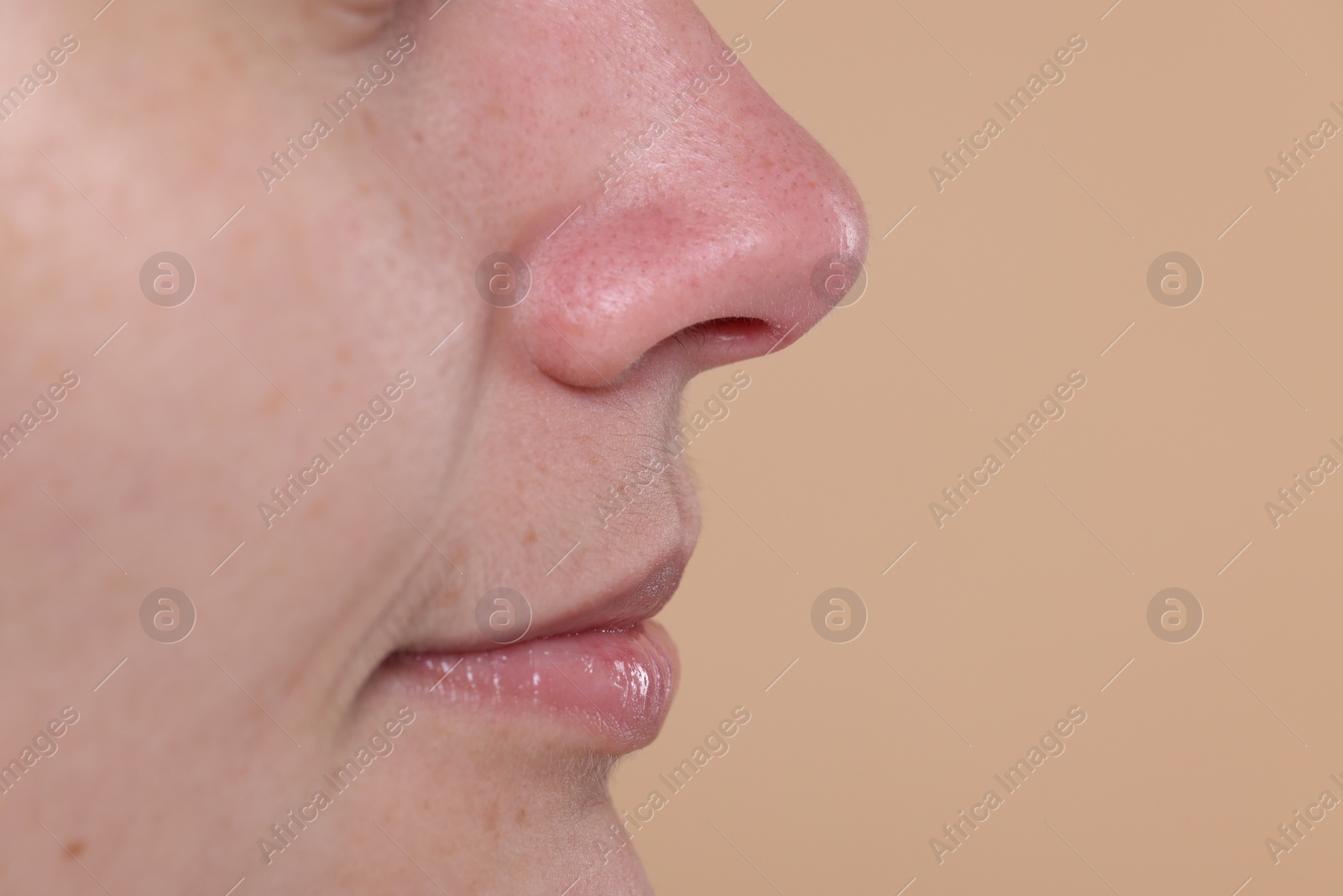 Photo of Closeup view of woman with blackheads on her nose against beige background, space for text