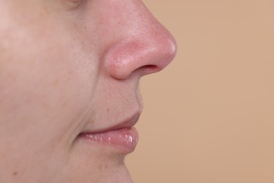 Closeup view of woman with blackheads on her nose against beige background, space for text