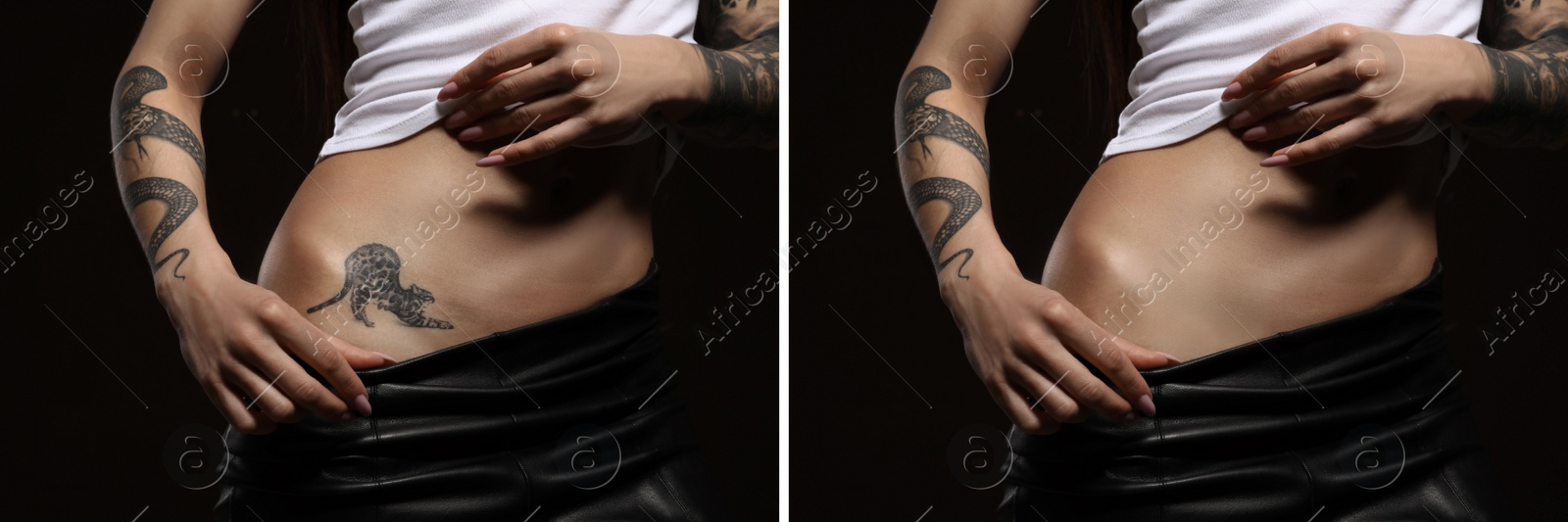 Image of Woman before and after laser tattoo removal procedure on black background, closeup. Collage with photos, banner design