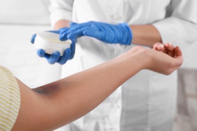 Photo of Doctor applying salve on woman's elbow with bruise in hospital, closeup