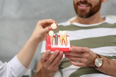 Photo of Doctor showing patient educational model of dental implant in clinic, closeup