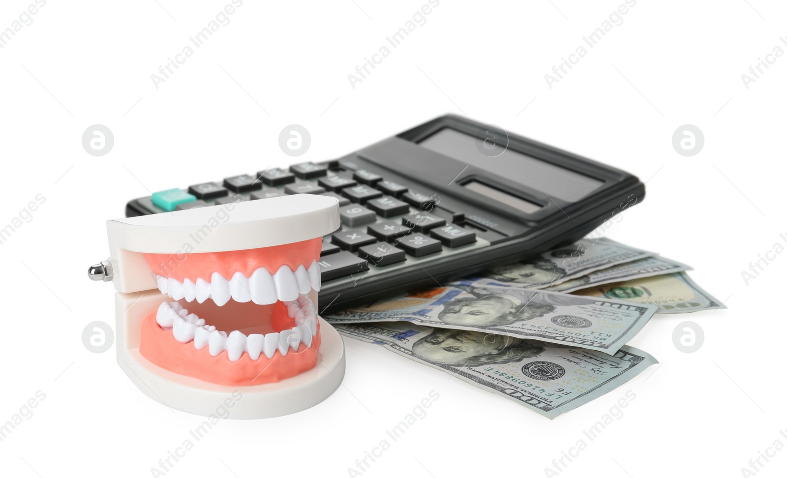 Photo of Educational dental typodont model, calculator and dollar banknotes on white background. Expensive treatment