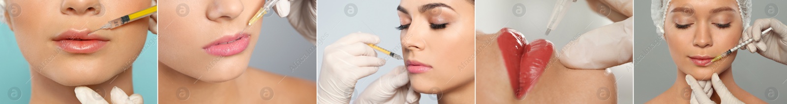 Image of Collage with photos of women during procedures of lip augmentation and permanent makeup, closeup. Banner design