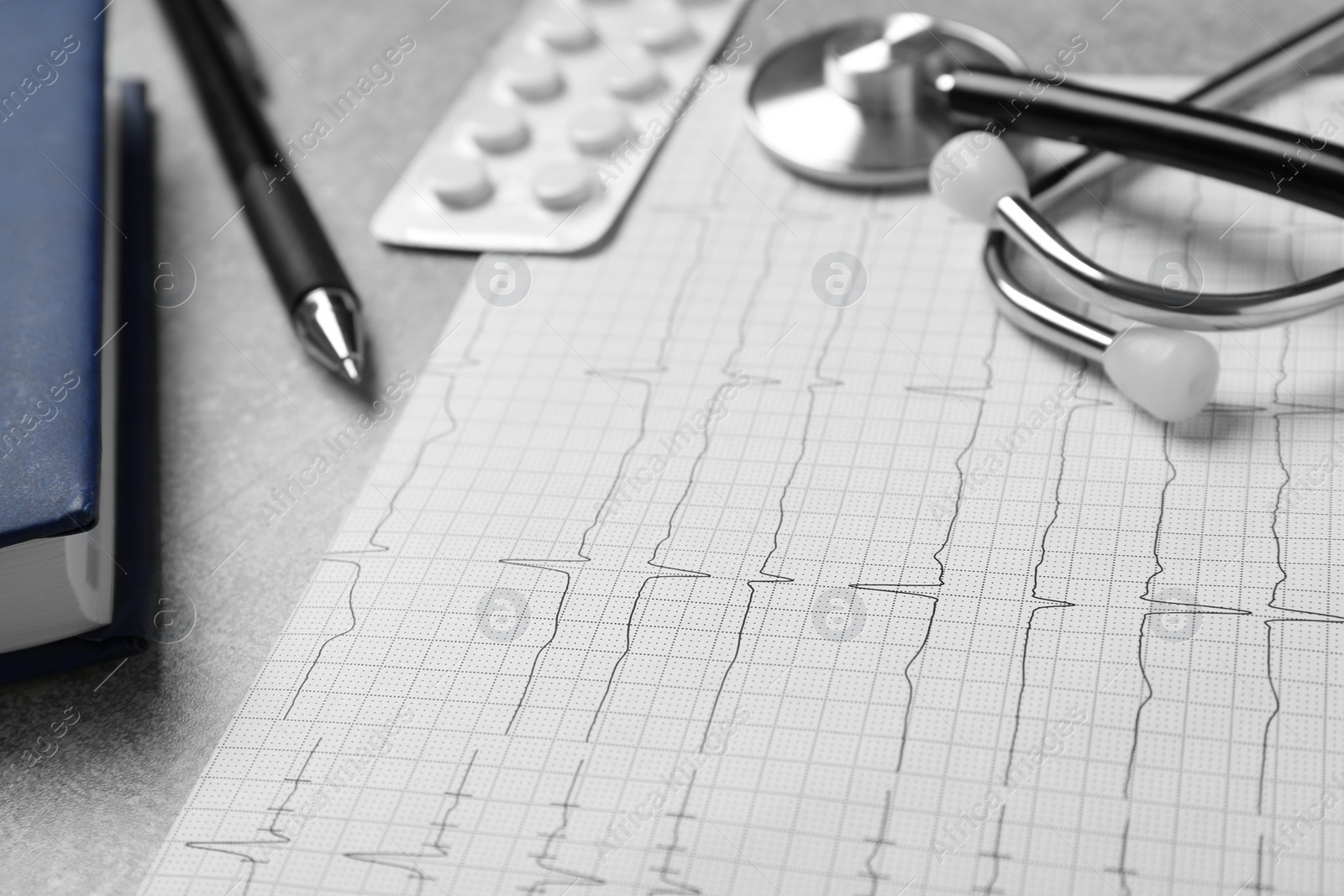 Photo of Cardiogram report, stethoscope and notebook on table, closeup