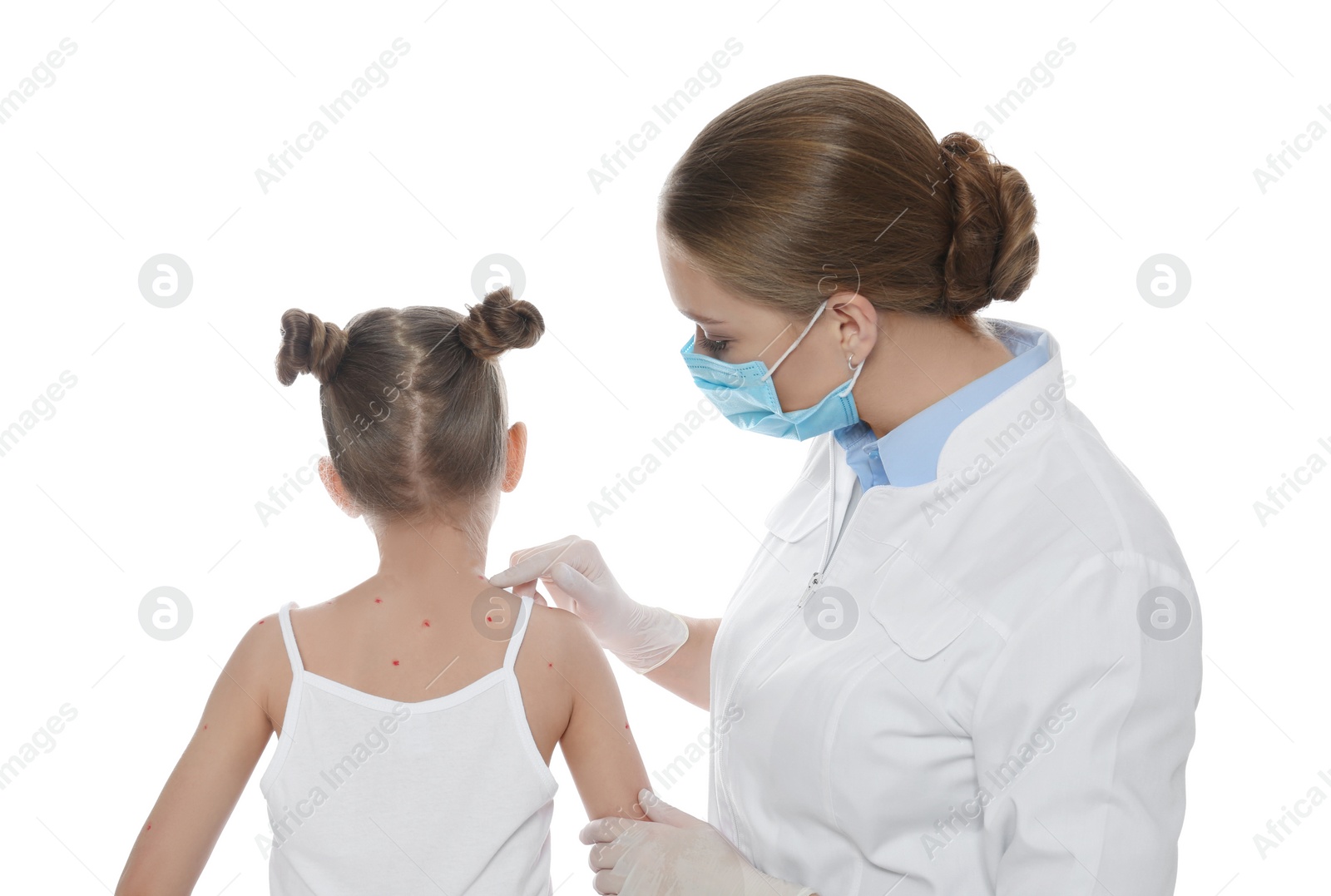 Photo of Doctor examining little girl with chickenpox on white background. Varicella zoster virus