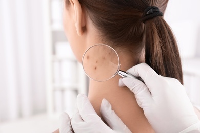 Dermatologist examining patient with magnifying glass in clinic, closeup view