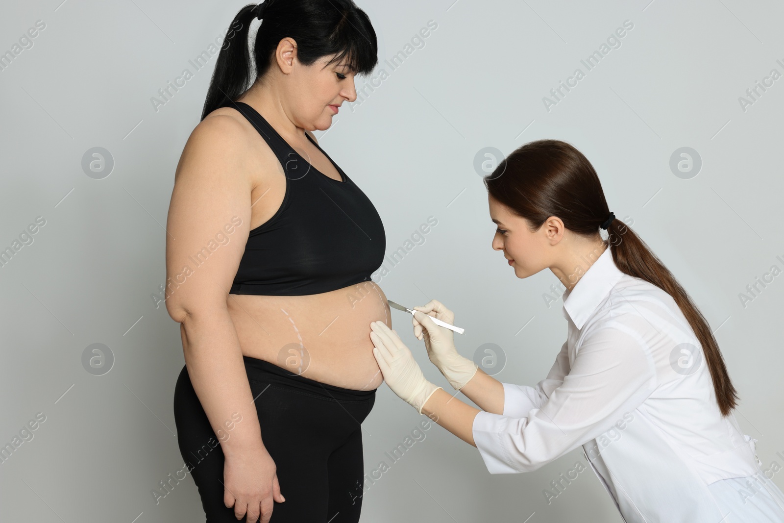 Photo of Doctor with scalpel near obese woman on light background. Weight loss surgery