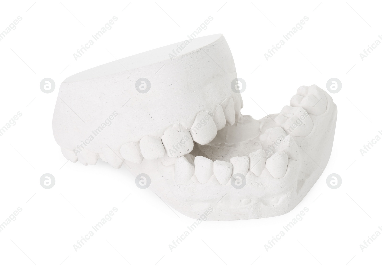 Photo of Dental model with gums isolated on white. Cast of teeth