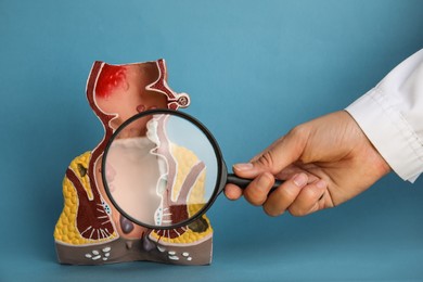 Photo of Proctologist holding magnifying glass near anatomical model of rectum with hemorrhoids on light blue background, closeup