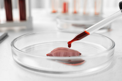 Image of Dripping blood from pipette into Petri dish on table, closeup. Laboratory analysis