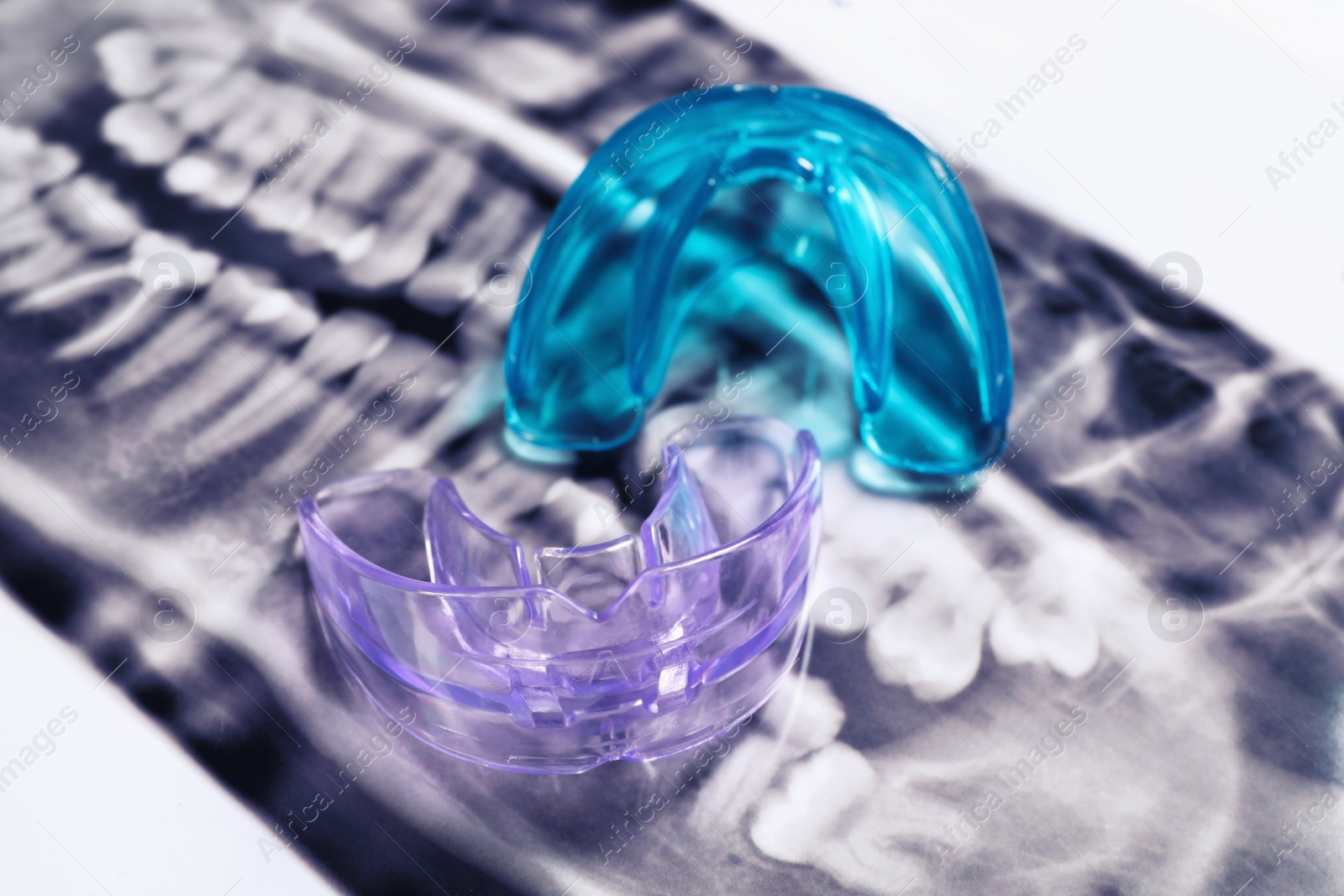 Photo of Mouth guards on dental scan, closeup. Bite correction