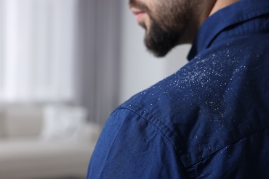 Man with dandruff on his shirt indoors, closeup. Space for text