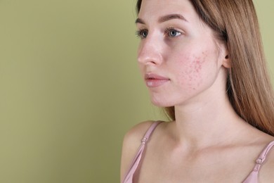 Photo of Young woman with acne problem on olive background. Space for text