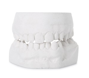 Photo of Dental model with gums isolated on white. Cast of teeth