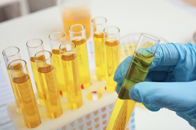 Photo of Doctor holding test tube with urine sample for analysis, closeup