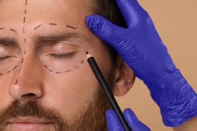 Doctor drawing marks on man's face for cosmetic surgery operation against beige background, closeup
