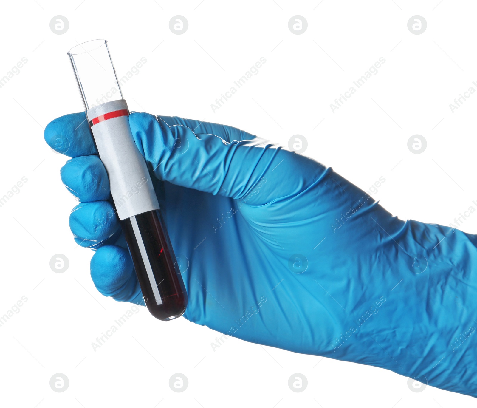 Photo of Laboratory worker holding test tube with blood sample for analysis isolated on white, closeup