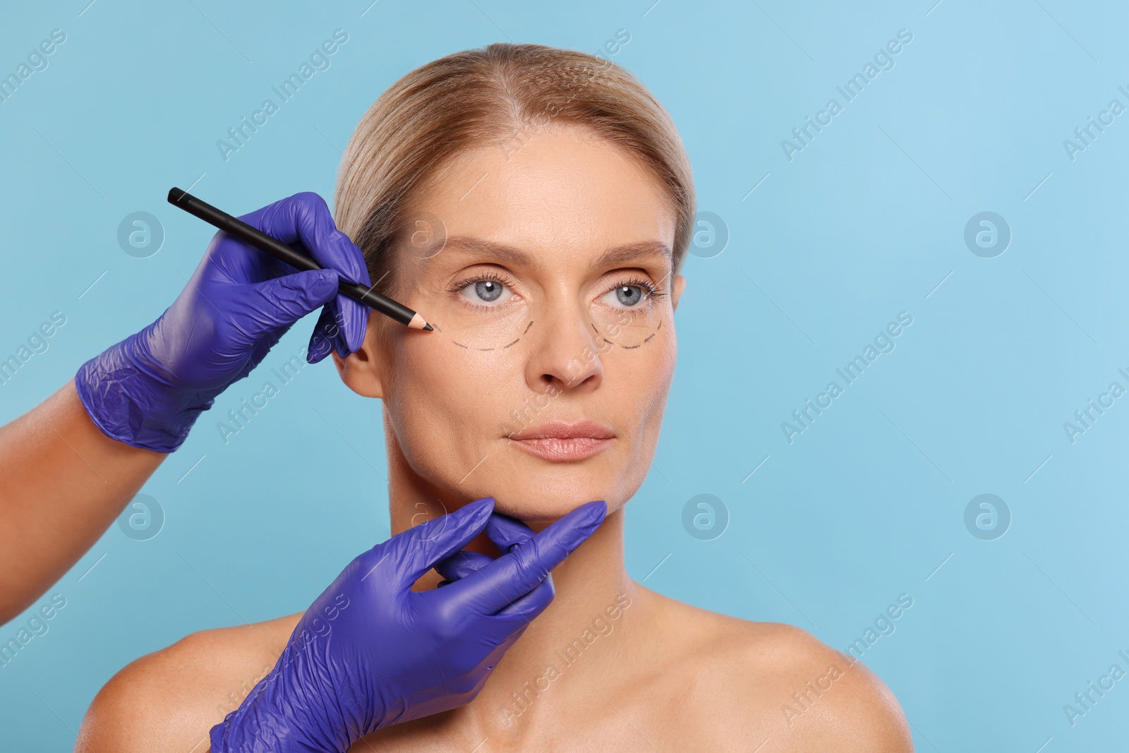 Photo of Doctor with pencil preparing patient for cosmetic surgery operation on light blue background