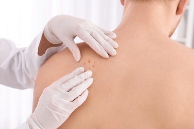 Photo of Dermatologist examining patient in clinic, closeup view