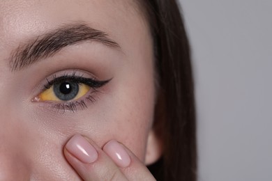 Photo of Woman with yellow eyes on light grey background, closeup. Symptom of hepatitis