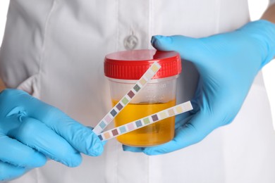 Nurse holding test strips and container with urine sample for analysis, closeup