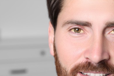 Man with yellow eyes on blurred background, closeup. Symptom of hepatitis