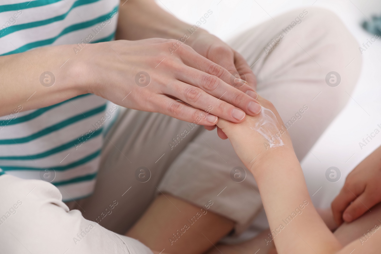 Photo of Mother applying ointment onto her daughter's hand on bed, closeup