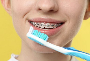 Smiling woman with dental braces cleaning teeth on yellow background, closeup