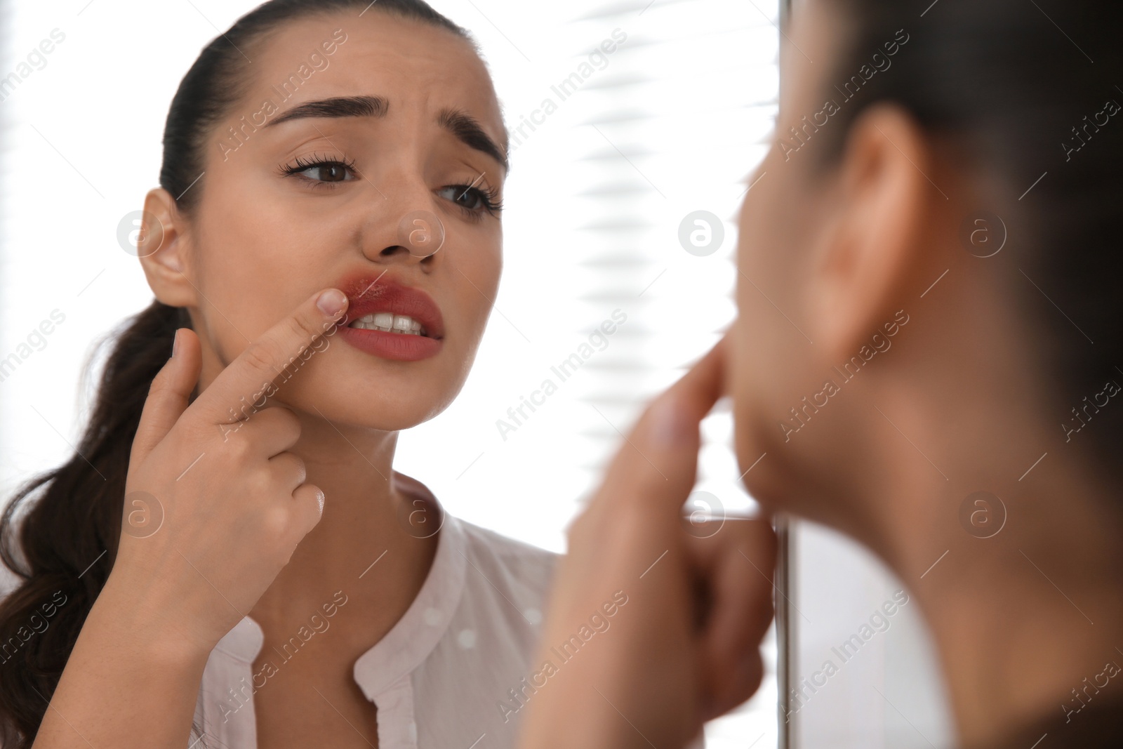Photo of Young woman with herpes touching lips in front of mirror at home