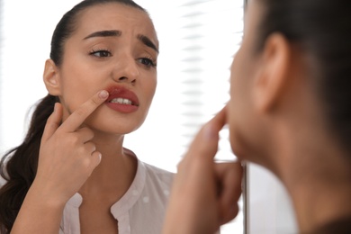 Young woman with herpes touching lips in front of mirror at home