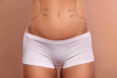 Woman with markings for cosmetic surgery on her abdomen against light brown background, closeup