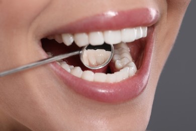 Photo of Examining woman's teeth with dentist's mirror on grey background, closeup