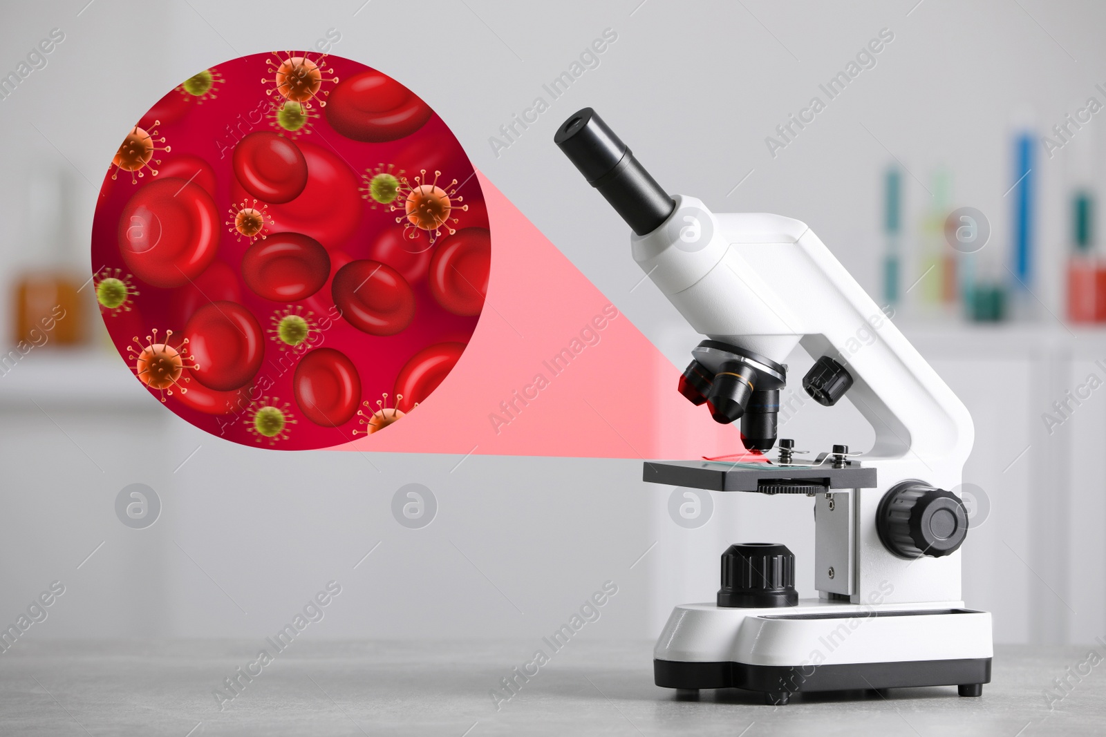 Image of Examination of blood sample with germs under microscope in laboratory