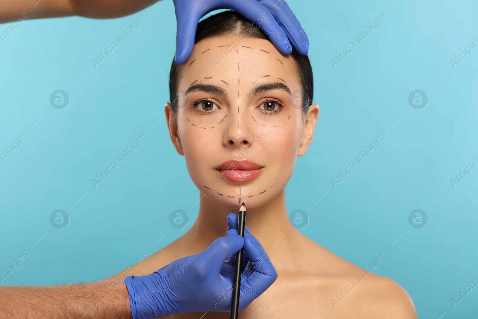 Photo of Doctor with pencil preparing patient for cosmetic surgery operation on light blue background