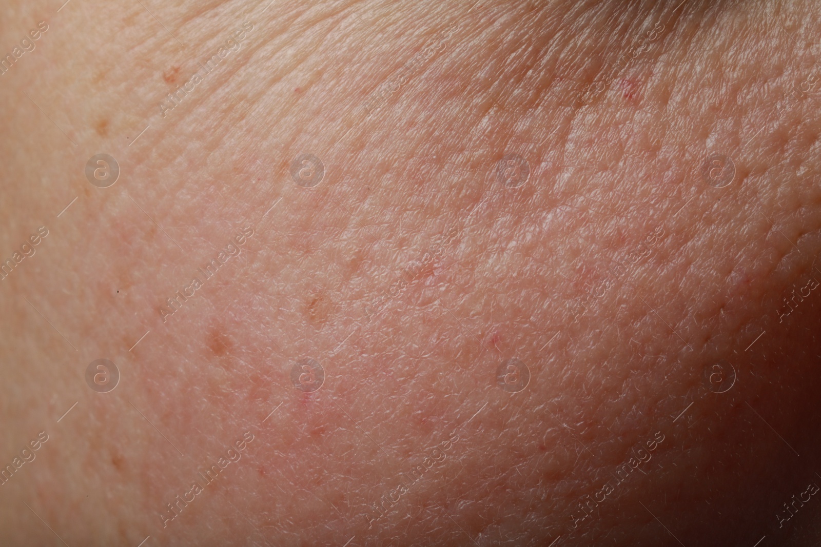 Photo of Closeup view of human skin as background