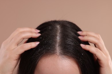 Photo of Woman examining her hair and scalp on beige background, closeup. Dandruff problem