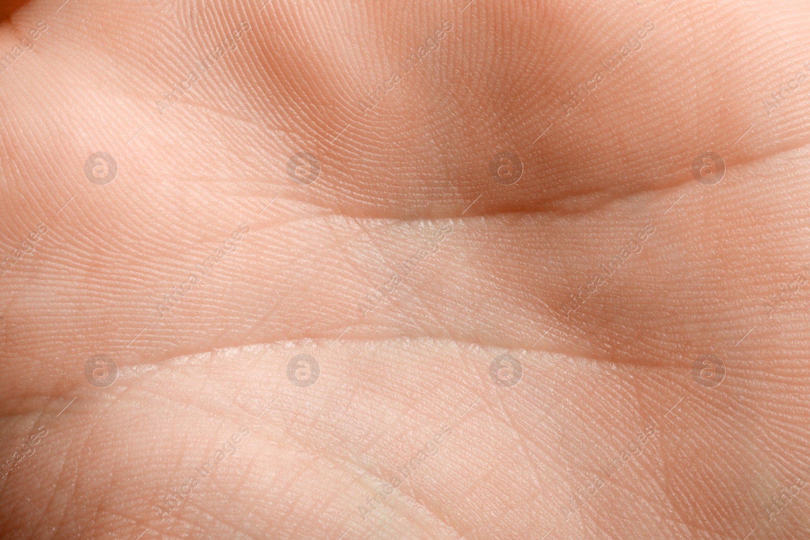 Photo of Closeup view of human hand with dry skin